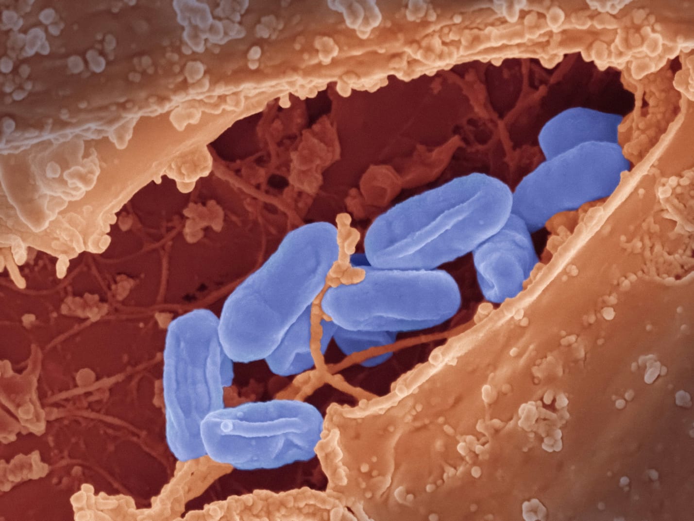 Illustration of bacterial cells representing chlamydia infection at a microscopic level inside the body