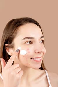 A woman gently applying acne treatment cream to her cheek as part of a skincare routine