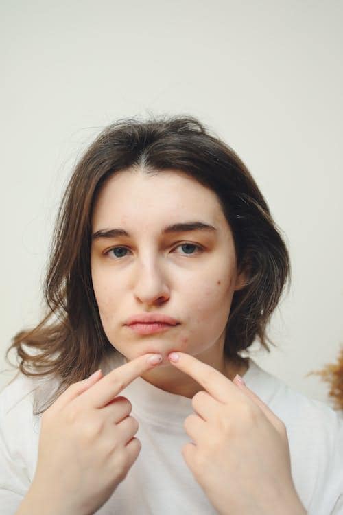 A woman holding her chin and looking concerned at a visible pimple on her face