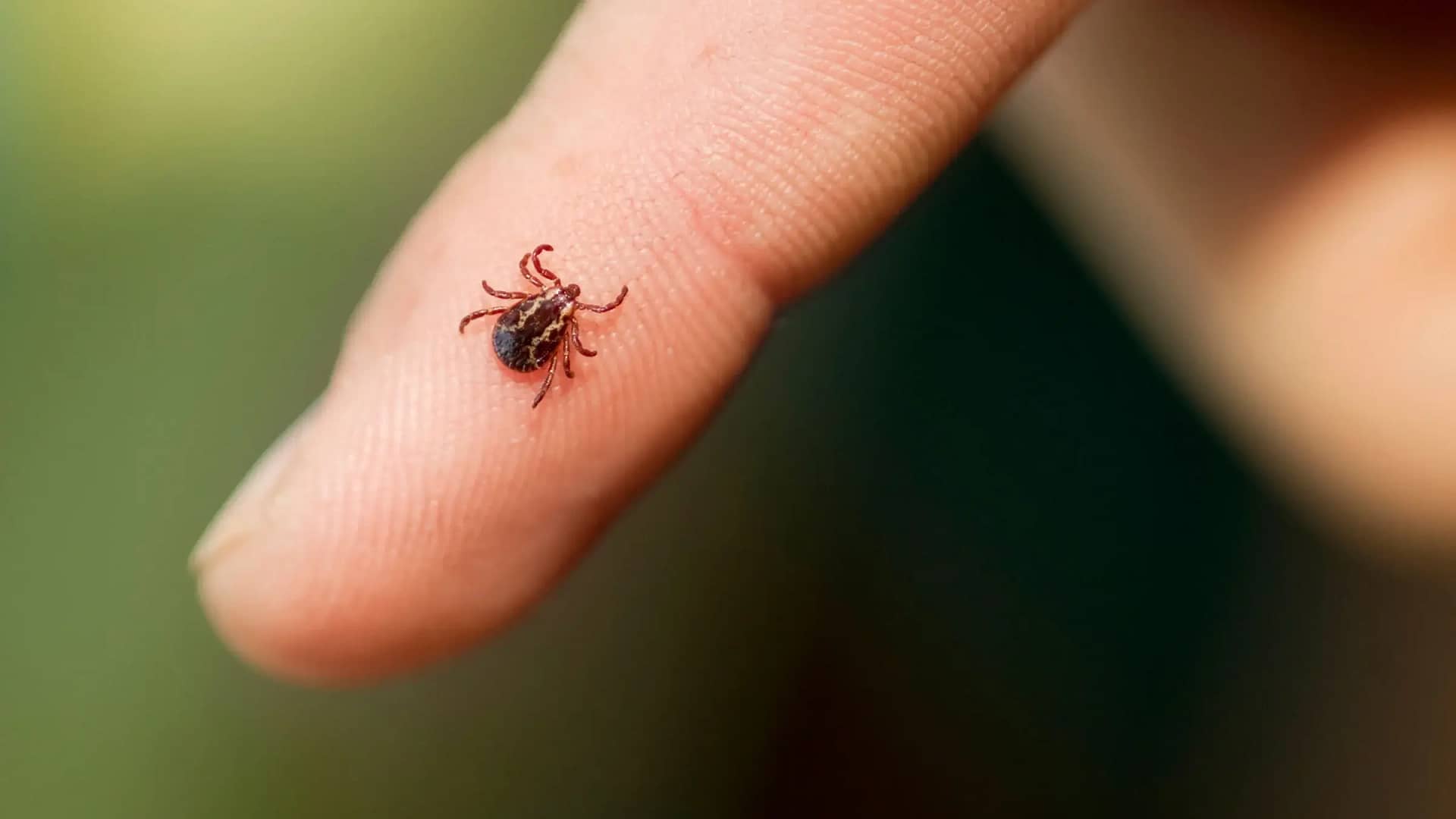 tick bite treatment