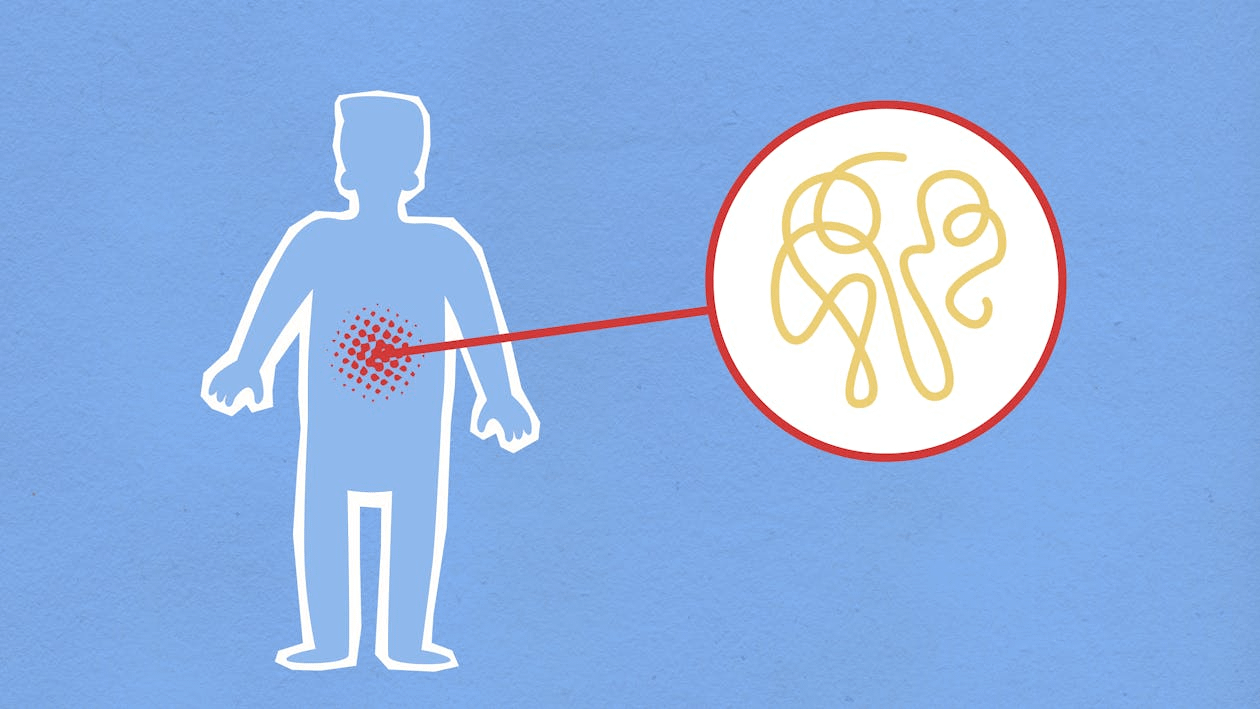 Illustration of a woman with symptoms of UTI